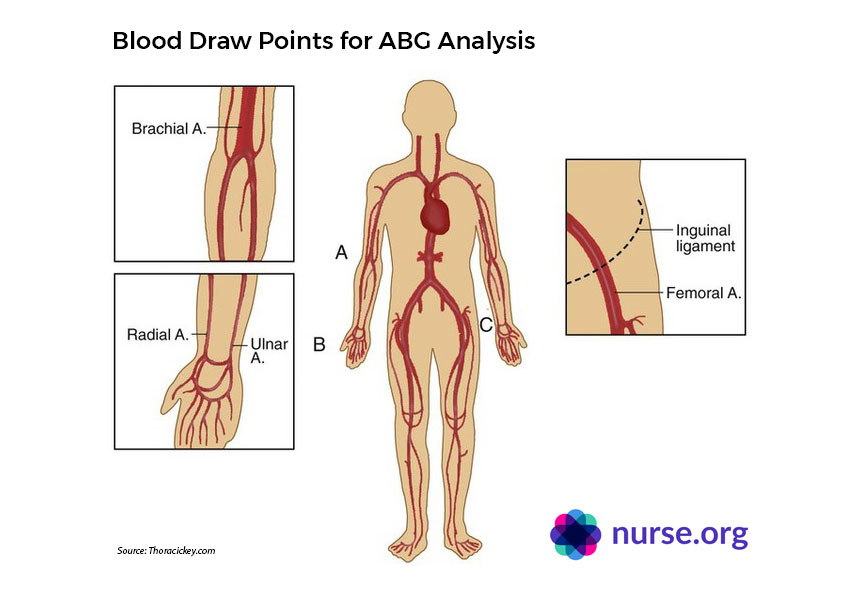 Arterial Blood Gas