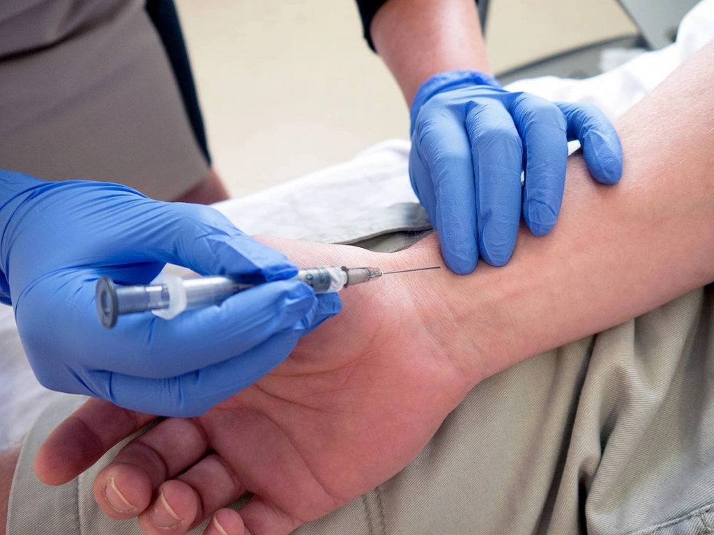 Arterial Blood Gas